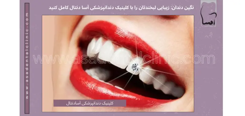 نگین دندان: زیبایی لبخندتان را با کلینیک دندانپزشکی آسا دنتال کامل کنید