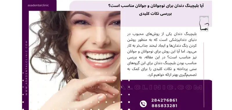 آیا بلیچینگ دندان برای نوجوانان و جوانان مناسب است؟ بررسی نکات کلیدی