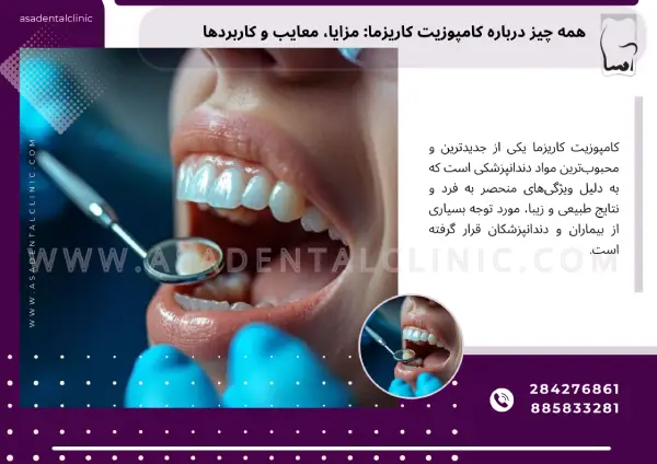 همه چیز درباره کامپوزیت کاریزما: مزایا، معایب و کاربردها