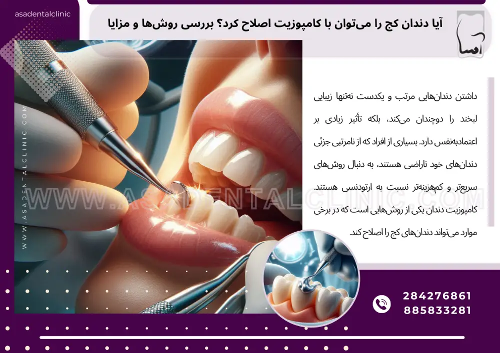 آیا دندان کج را می‌توان با کامپوزیت اصلاح کرد؟