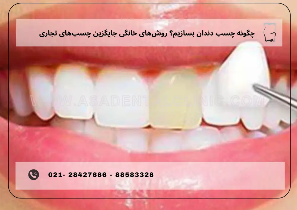 asadentalclinic (1) چگونه چسب دندان بسازیم؟ روشهای خانگی جایگزین چسبهای تجاری