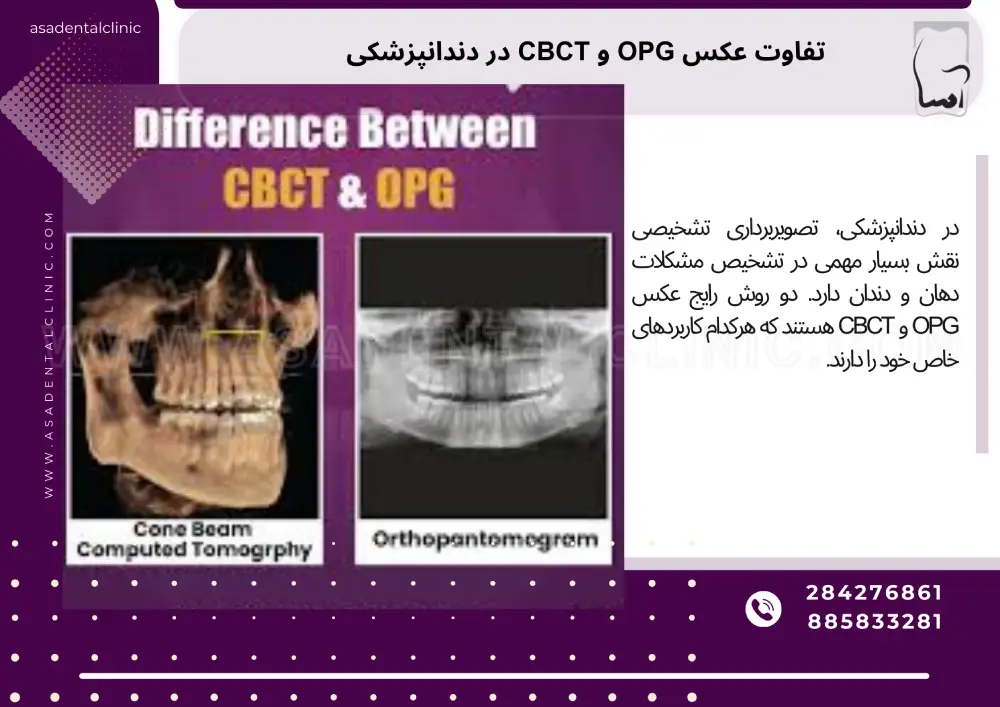 تفاوت عکس OPG و CBCT در دندانپزشکی