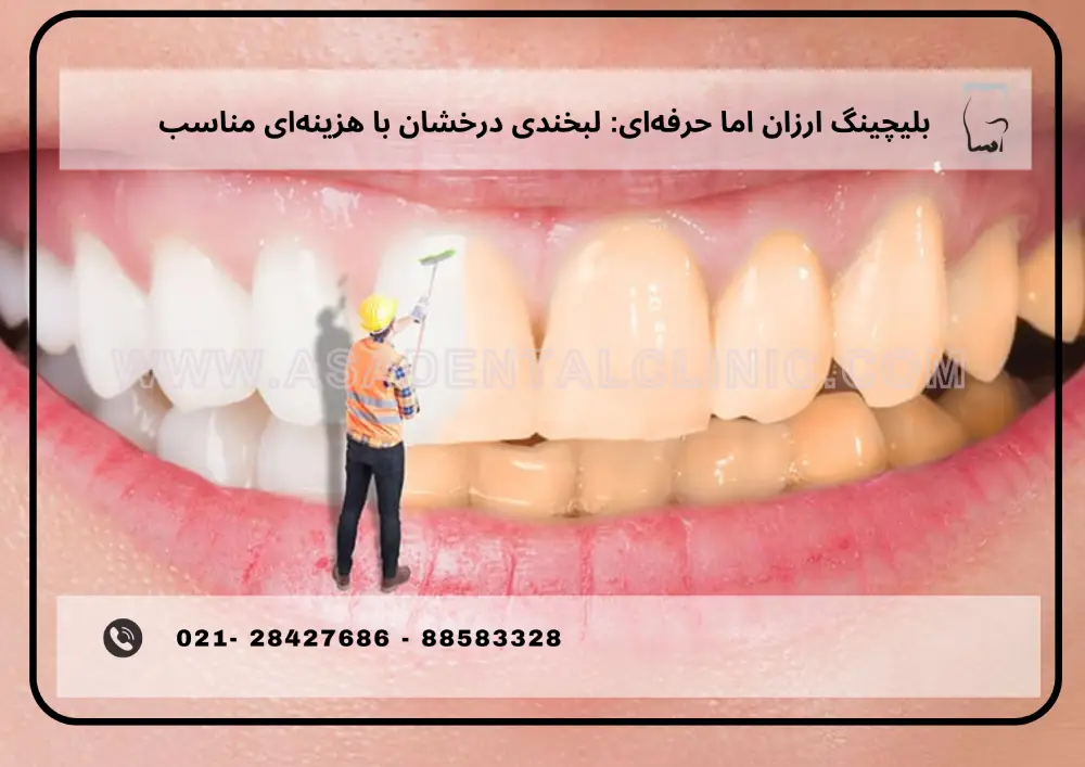 2 (4) بلیچینگ ارزان اما حرفهای