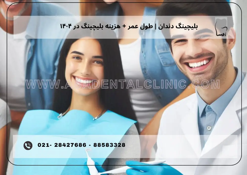Bleaching cost in 1404 (1) بلیچینگ دندان | طول عمر + هزینه بلیچینگ در ۱۴۰۴