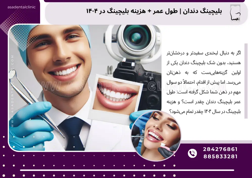 بلیچینگ دندان | طول عمر + هزینه بلیچینگ در ۱۴۰۴