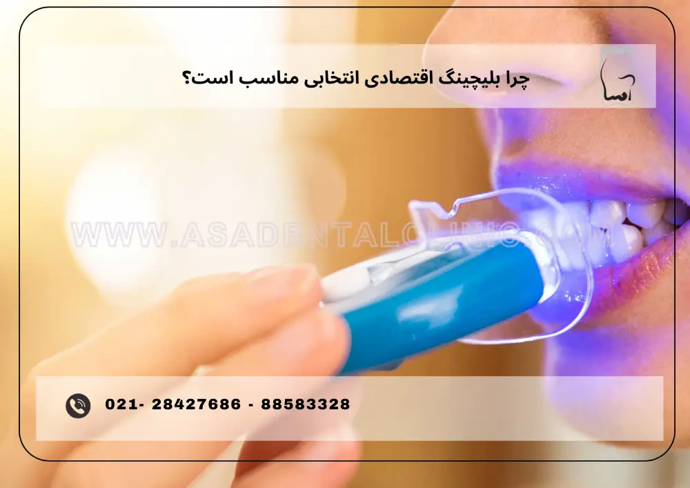 Economic bleaching (1) بلیچینگ اقتصادی