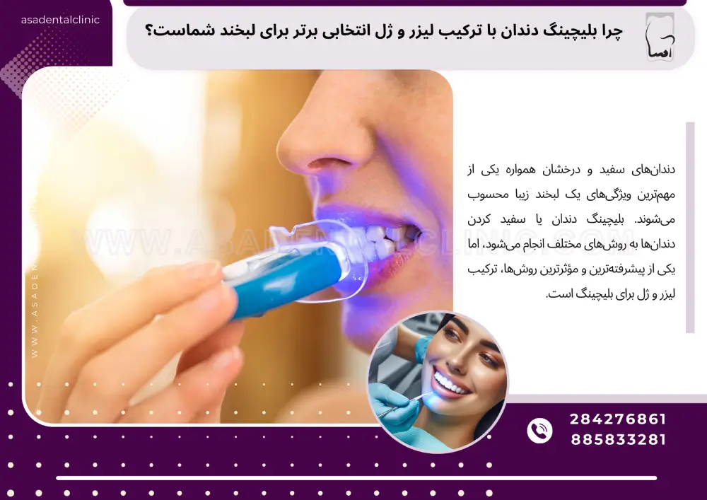 چرا بلیچینگ دندان با ترکیب لیزر و ژل انتخابی برتر برای لبخند شماست؟