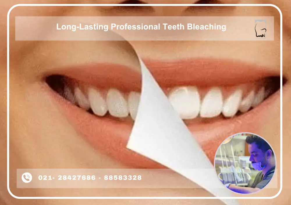 Asadental Dental Clinic (1) Professional Teeth Bleaching with Long-Lasting Results at Asadental Dental Clinic