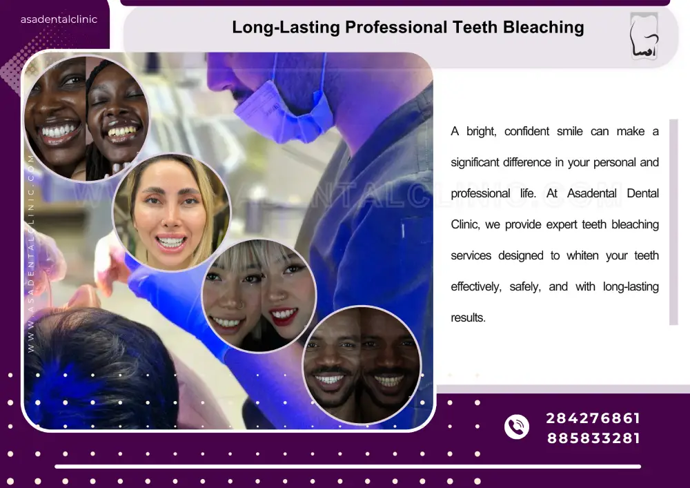 Asadental Dental Clinic Professional Teeth Bleaching with Long-Lasting Results at Asadental Dental Clinic