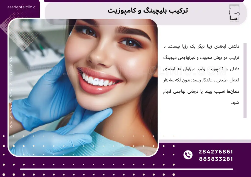 Combination of bleaching and composite ترکیب بلیچینگ و کامپوزیت