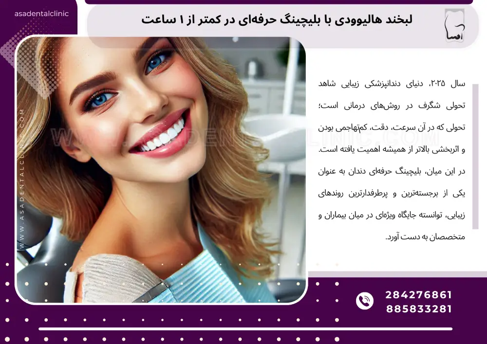 Hollywood smile with professional bleaching لبخند هالیوودی با بلیچینگ حرفهای