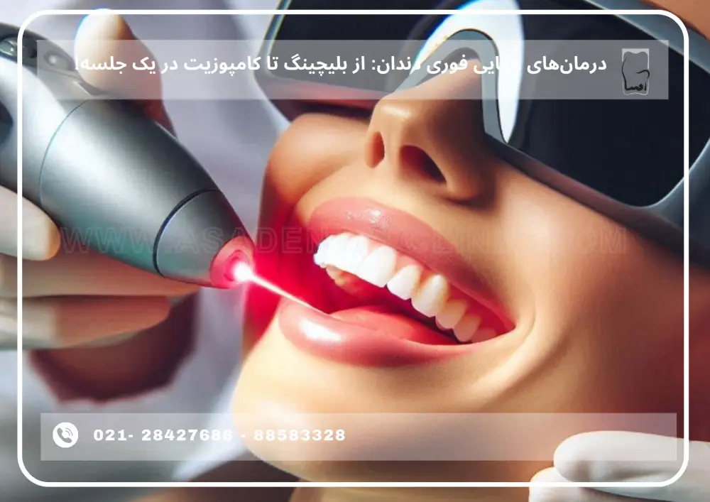 Immediate beauty of teeth (1) درمانهای زیبایی فوری دندان: از بلیچینگ تا کامپوزیت در یک جلسه!