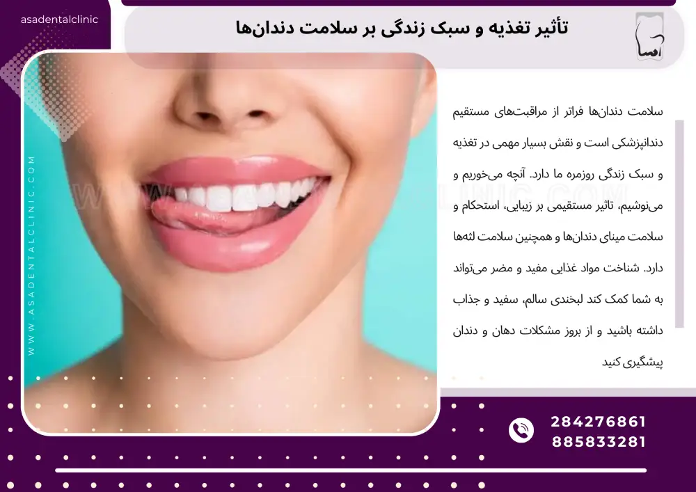 Lifestyle on dental health تأثیر تغذیه و سبک زندگی بر سلامت دندانها