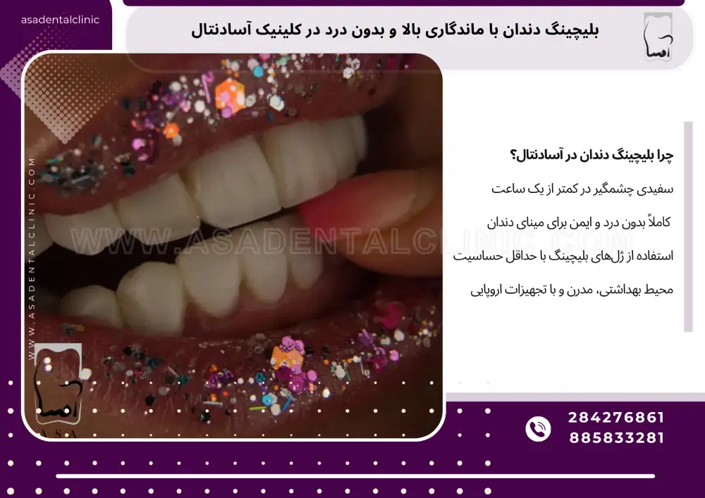 Long-lasting teeth bleaching لیچینگ دندان با ماندگاری بالا و بدون درد در کلینیک آسادنتال