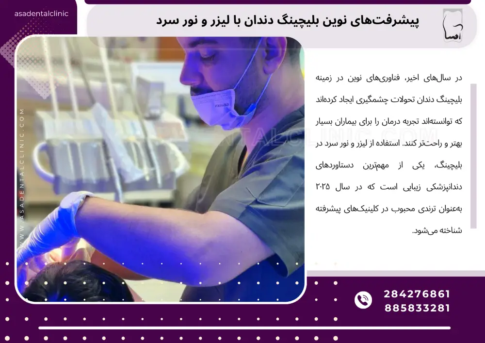 Teeth bleaching with laser and cold light بلیچینگ دندان با لیزر و نور سرد