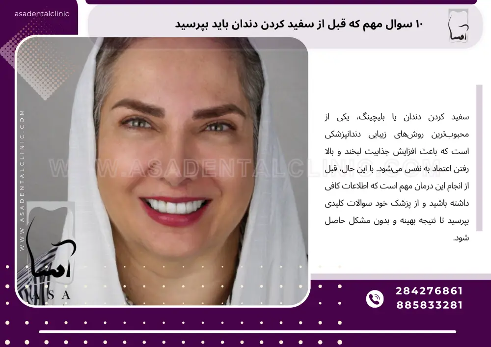 Teeth whitening at an affordable price بلیچینگ دندان با قیمت مناسب و شرایط اقساطی در تهران