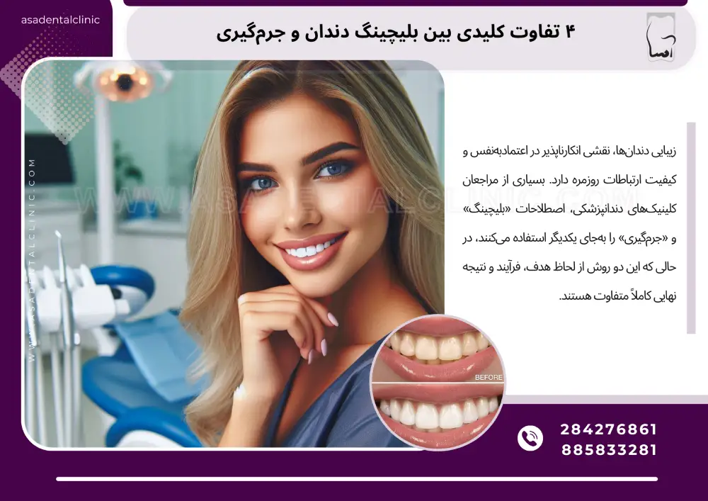The difference between bleaching and descaling ۴ تفاوت کلیدی بین بلیچینگ دندان و جرمگیری | کدام روش برای شما مناسبتر است؟