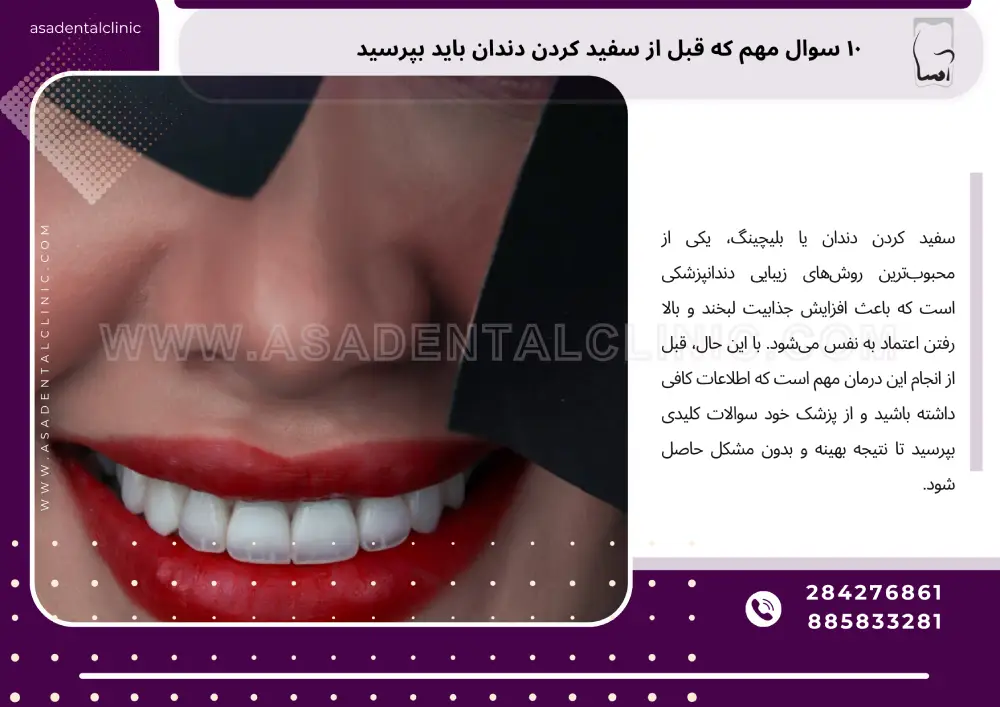 teeth whitening ۱۰ سوال مهم که قبل از سفید کردن دندان باید بپرسید