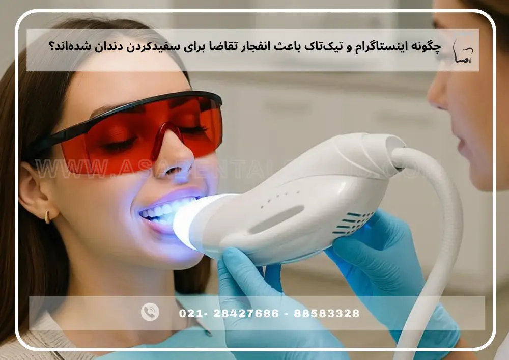 teeth whitening (1)