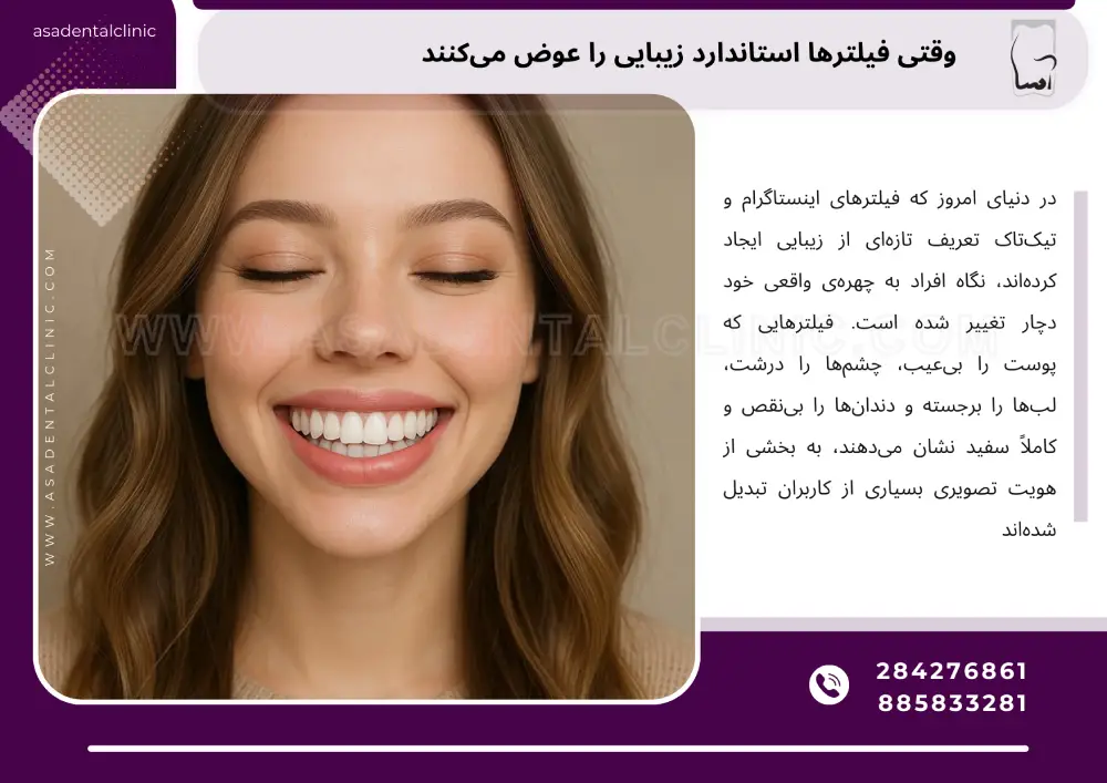 برای سفیدکردن دندان یا همان بلیچینگ دندان