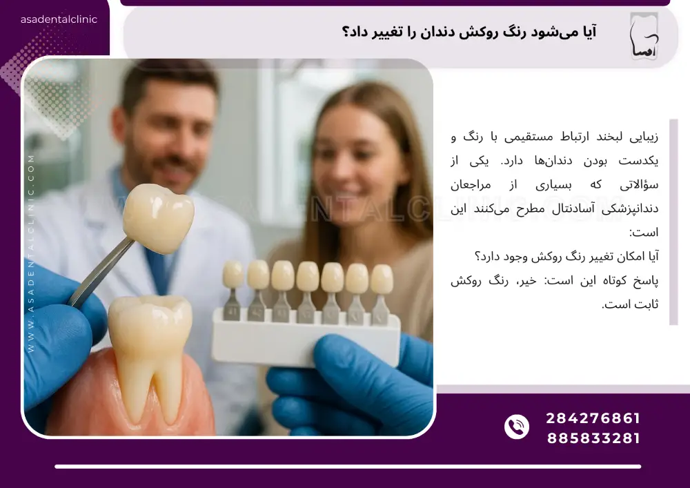 آیا میشود رنگ روکش دندان را تغییر داد؟