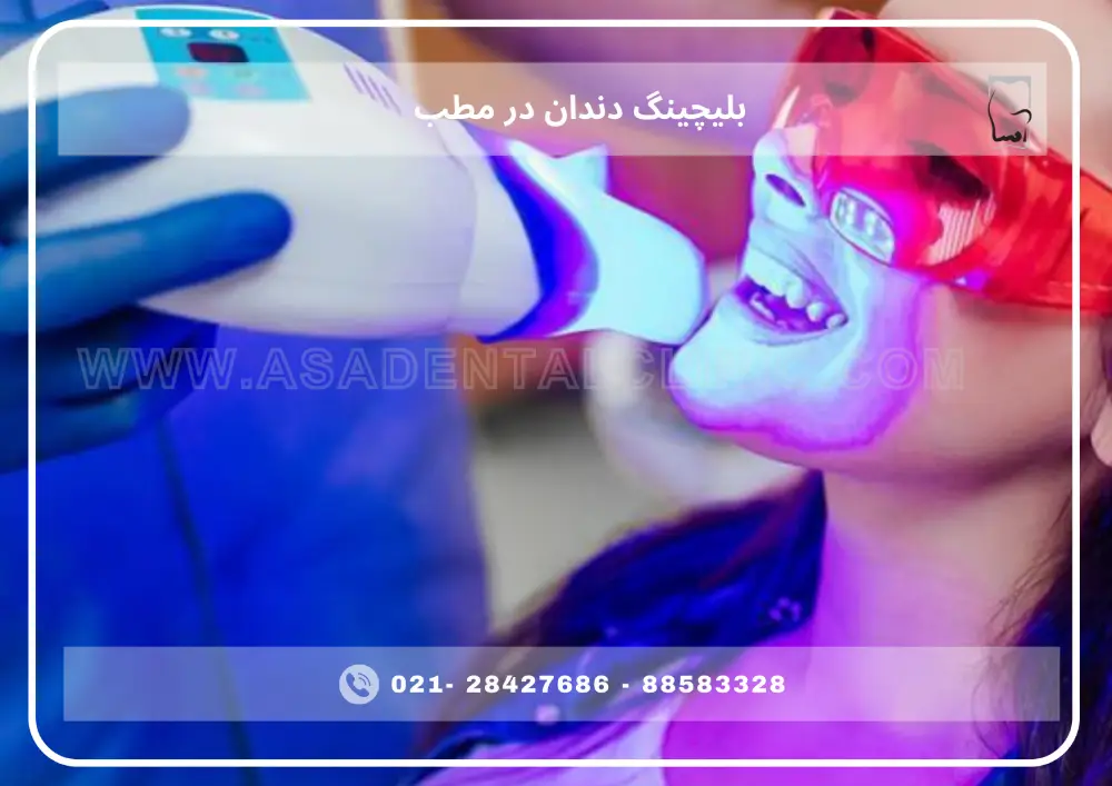 Teeth bleaching (1) بلیچینگ دندان در مطب در مقابل کیتهای خانگی؛ تفاوت در نتیجه و ماندگاری