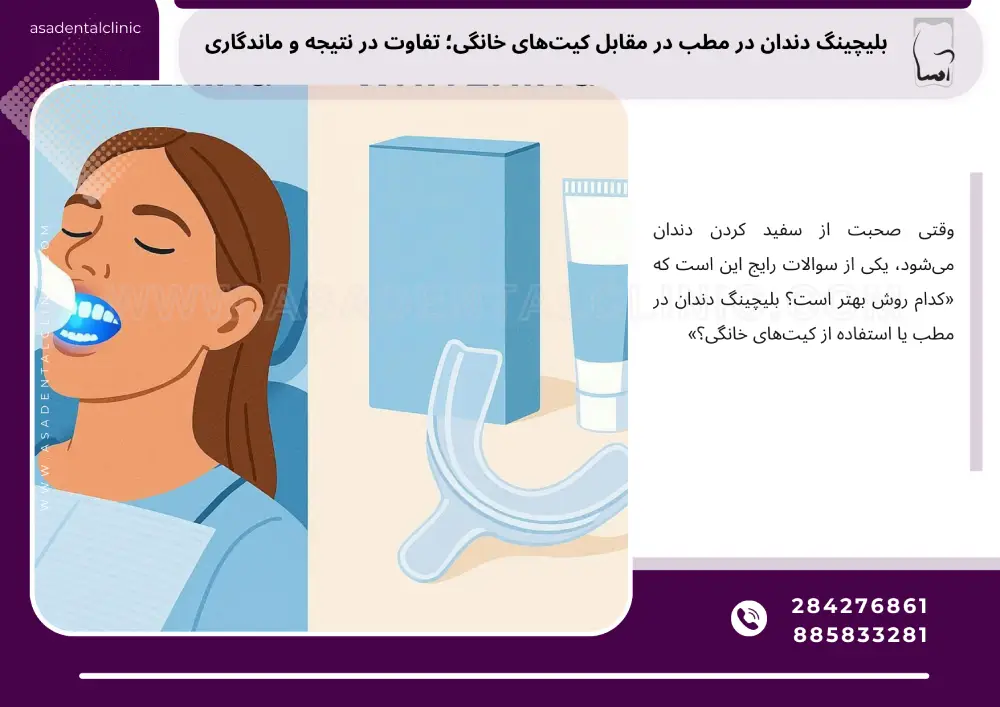بلیچینگ دندان در مطب در مقابل کیتهای خانگی؛ تفاوت در نتیجه و ماندگاری