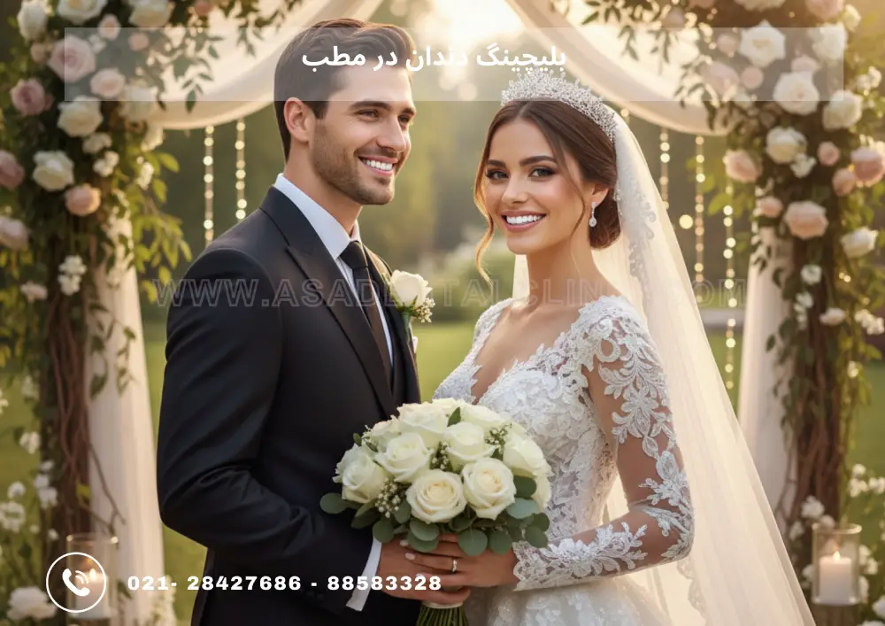 teeth whitening (1) سفید کردن دندان مخصوص عروس و دامادها