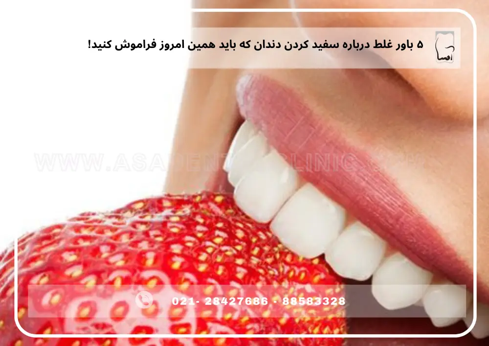teeth whitening (3) ۵ باور غلط درباره سفید کردن دندان که باید همین امروز فراموش کنید!