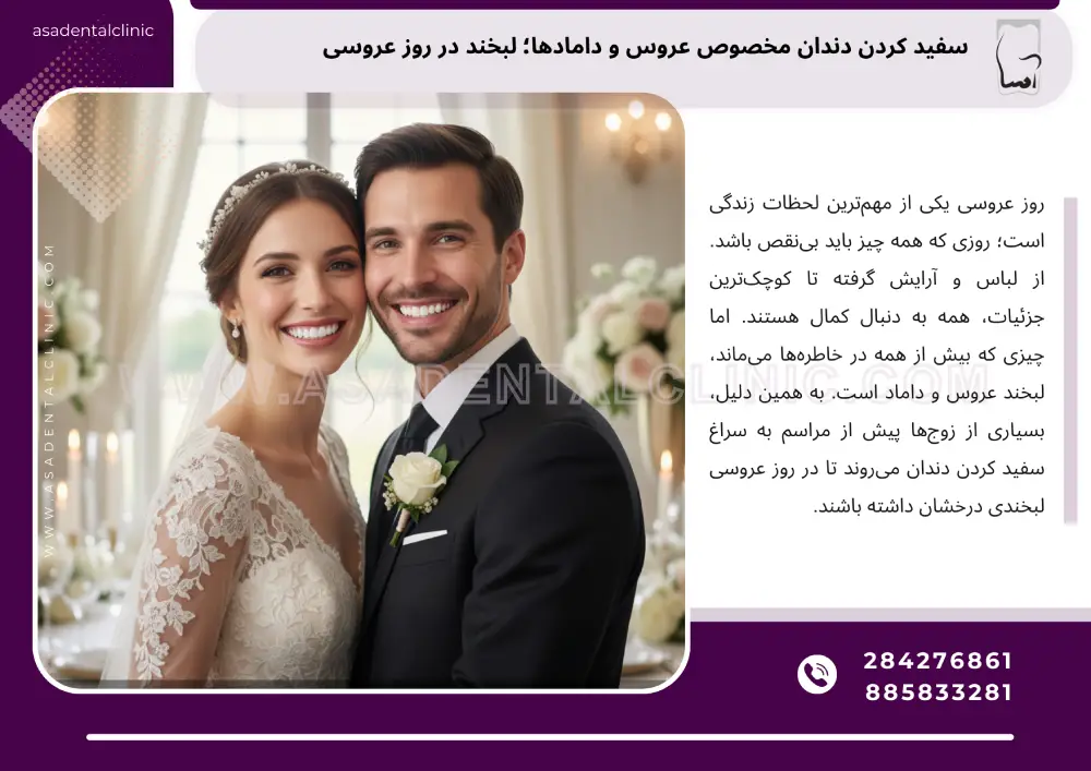 سفید کردن دندان مخصوص عروس و دامادها
