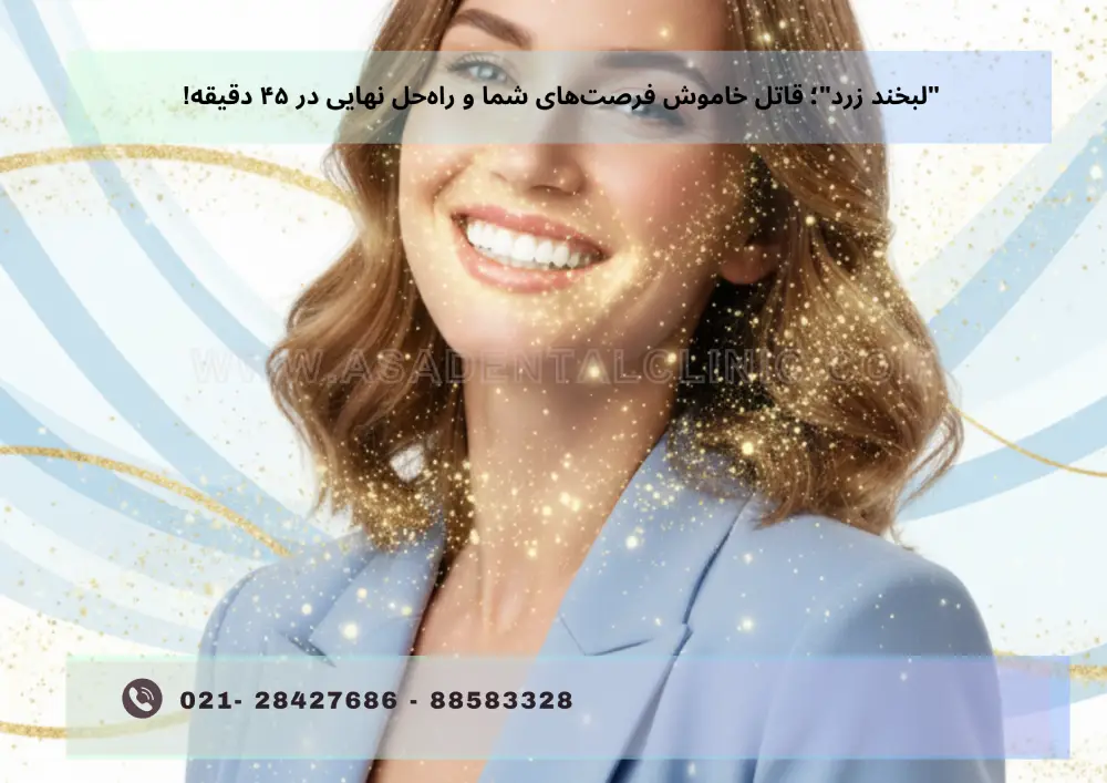 Teeth bleaching (1) بلیچینگ دندان