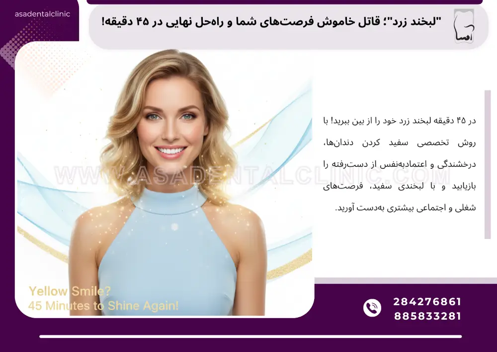 بلیچینگ دندان