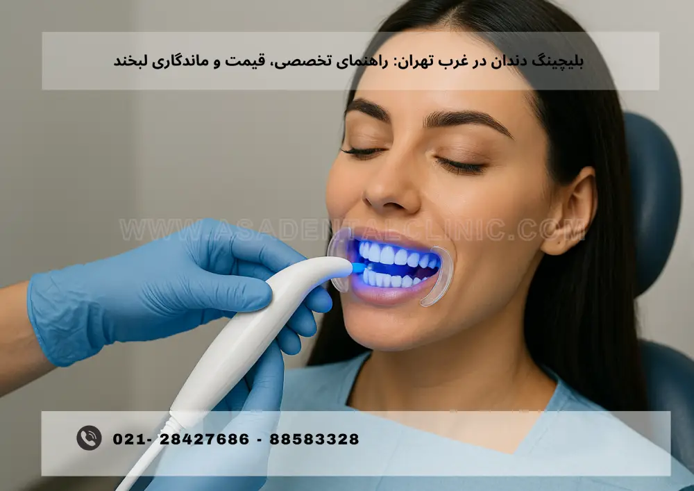 Teeth bleaching (3) بلیچینگ دندان در غرب تهران: راهنمای تخصصی، قیمت و ماندگاری لبخند
