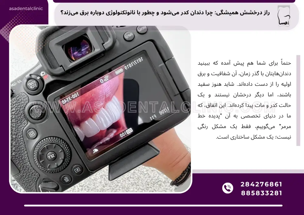 چرا دندان کدر میشود و چطور با نانوتکنولوژی دوباره برق میزند؟