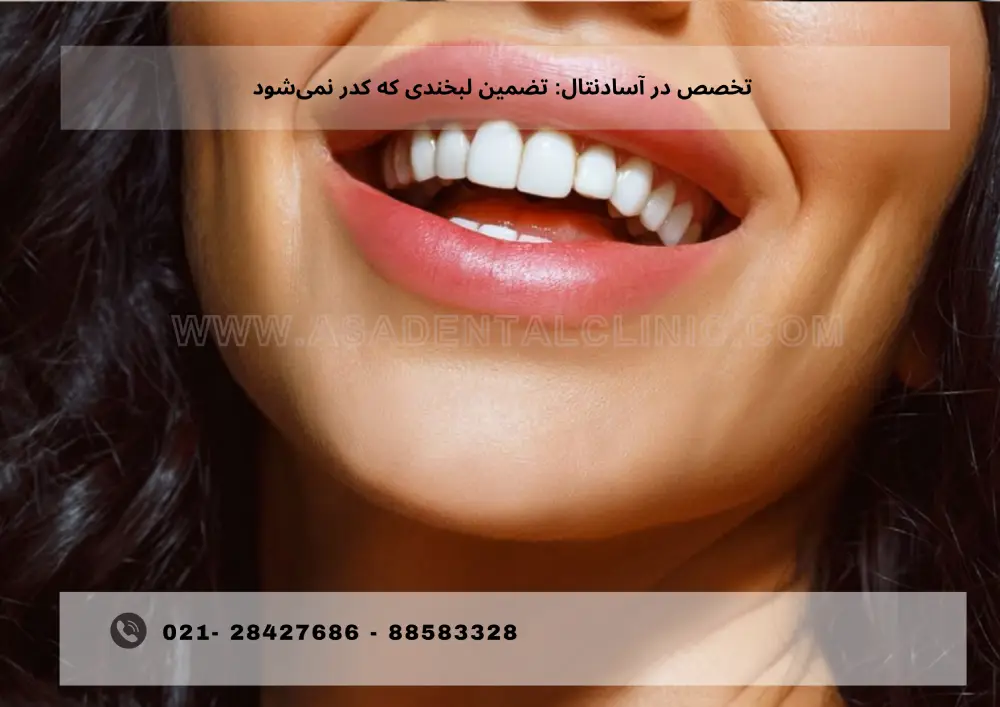 Teeth bleaching (5) چرا دندان کدر میشود و چطور با نانوتکنولوژی دوباره برق میزند؟