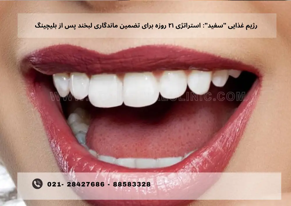 Teeth bleaching (7) استراتژی ۲۱ روزه برای تضمین ماندگاری لبخند پس از بلیچینگ