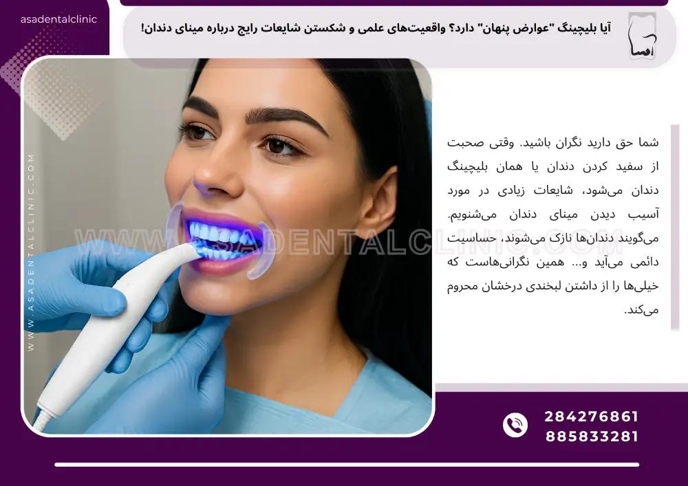 بلیچینگ دندان