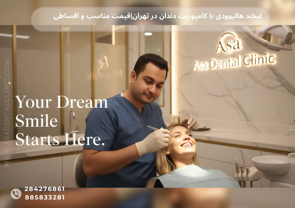 لبخند هالیوودی با کامپوزیت دندان در تهران|قیمت مناسب و اقساطی