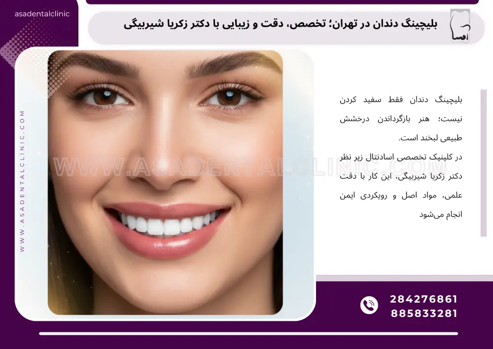 بلیچینگ دندان در تهران