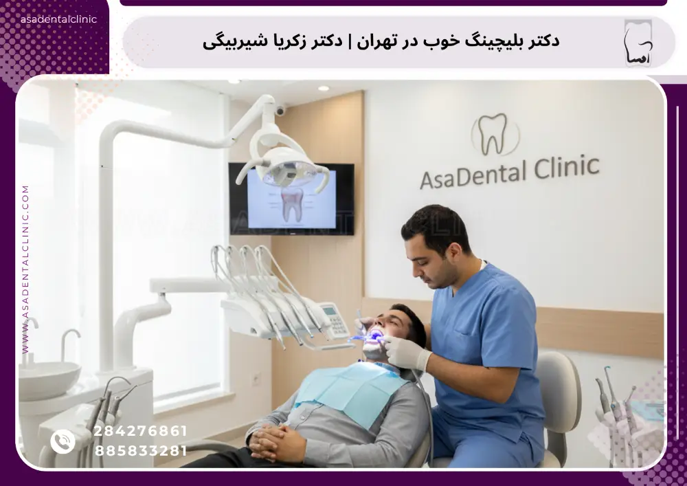 دکتر بلیچینگ خوب در تهران | بلیچینگ تخصصی دندان با دکتر زکریا شیربیگی در کلینیک اسادنتال