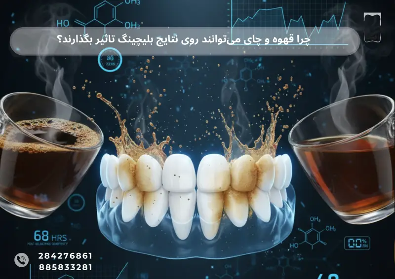 چرا قهوه و چای می‌توانند روی نتایج بلیچینگ تاثیر بگذارند؟