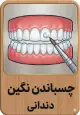 چسباندن نگین هزینه
