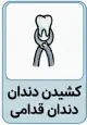 تعرفه کشیدن دندان
