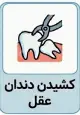 کشیدن دندان عقل هزینه