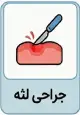 جراحی لثه (هر دندان)