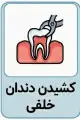 کشیدن دندان خلفی