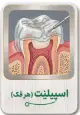 اسپیلینت (هر فک)