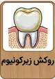 هزینه روکش دندان 1405
