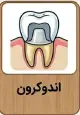 اندوکرون