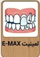 قیمت لمینت